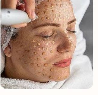 Tratamiento BB Glow