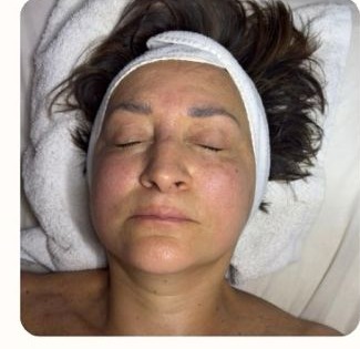 Facial de rejuvenecimiento